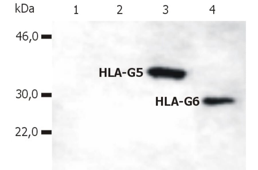 Western Blot - Anti-HLA G Antibody [5A6G7] (A85876) - Antibodies.com