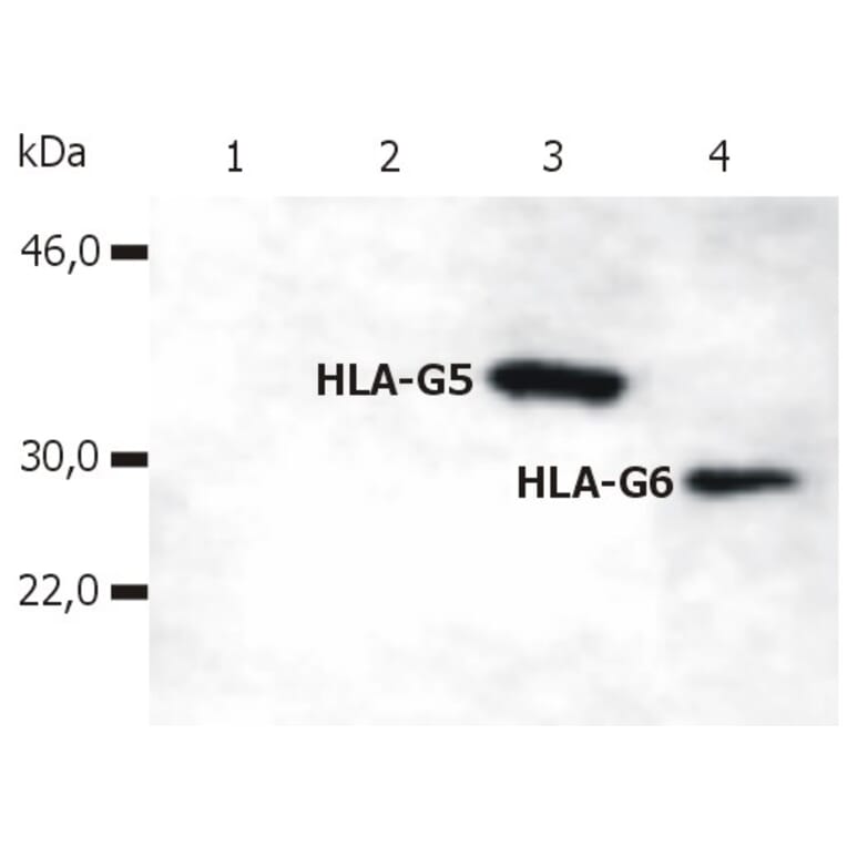 Western Blot - Anti-HLA G Antibody [5A6G7] (A85876) - Antibodies.com