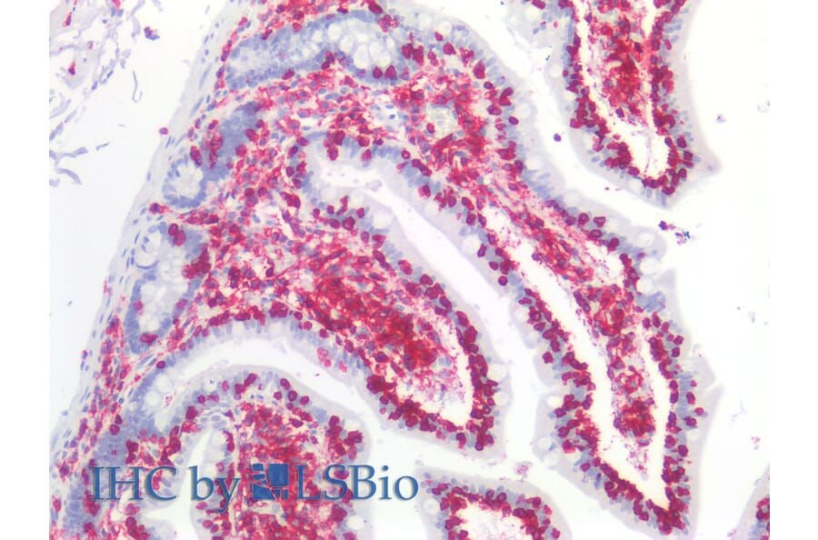 IHC - Anti-CD45 Antibody [MEM-28] (A85889)