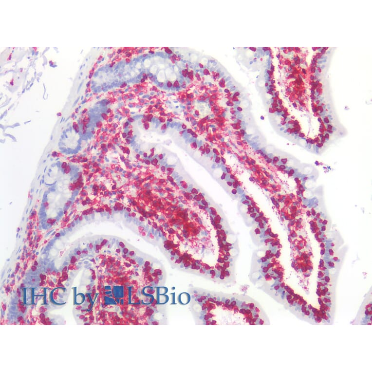 IHC - Anti-CD45 Antibody [MEM-28] (A85889)