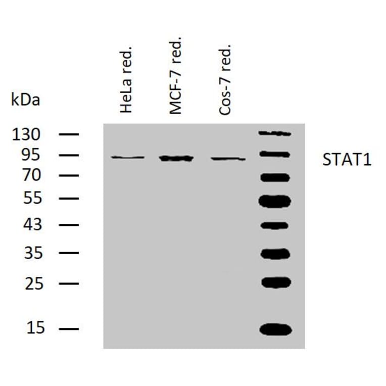 WB - Anti-STAT1 Antibody [SM2] (A85902)