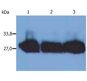 WB - Anti-Human Kappa Light Chain Antibody [MEM-09] (A85908)