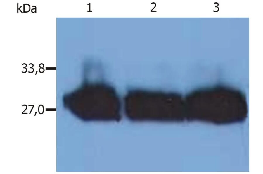 WB - Anti-Human Kappa Light Chain Antibody [MEM-09] (A85908)