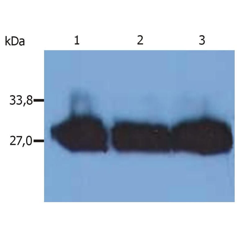 WB - Anti-Human Kappa Light Chain Antibody [MEM-09] (A85908)