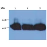 WB - Anti-Human Kappa Light Chain Antibody [MEM-09] (A85908)