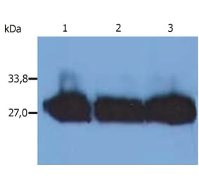Western Blot - Anti-Human Kappa Light Chain Antibody [MEM-09] (A85906) - Antibodies.com