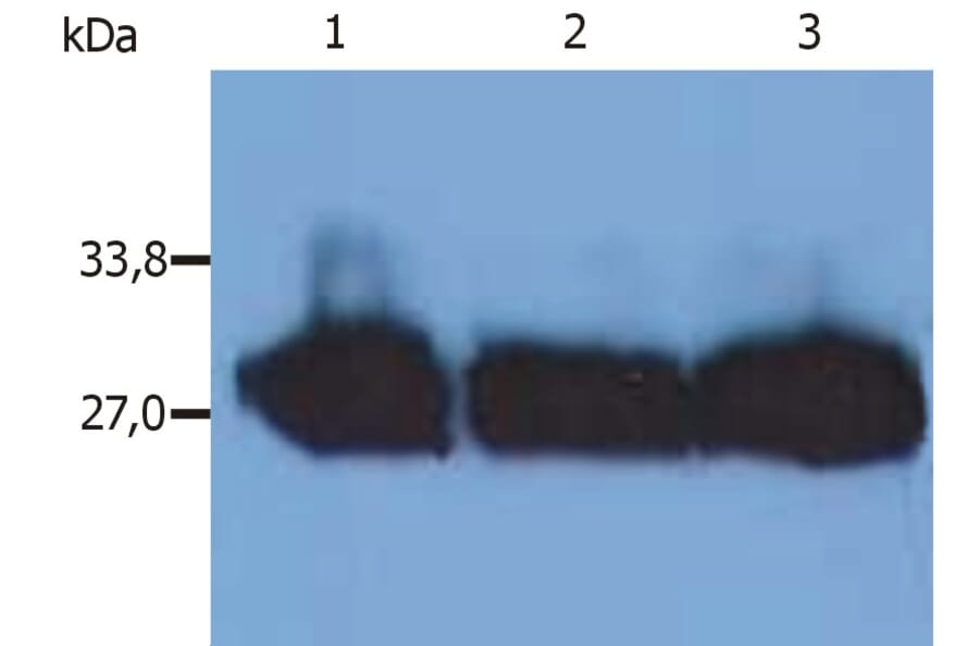 Western Blot - Anti-Human Kappa Light Chain Antibody [MEM-09] (A85906) - Antibodies.com