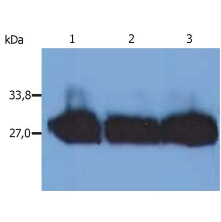 Western Blot - Anti-Human Kappa Light Chain Antibody [MEM-09] (A85906) - Antibodies.com