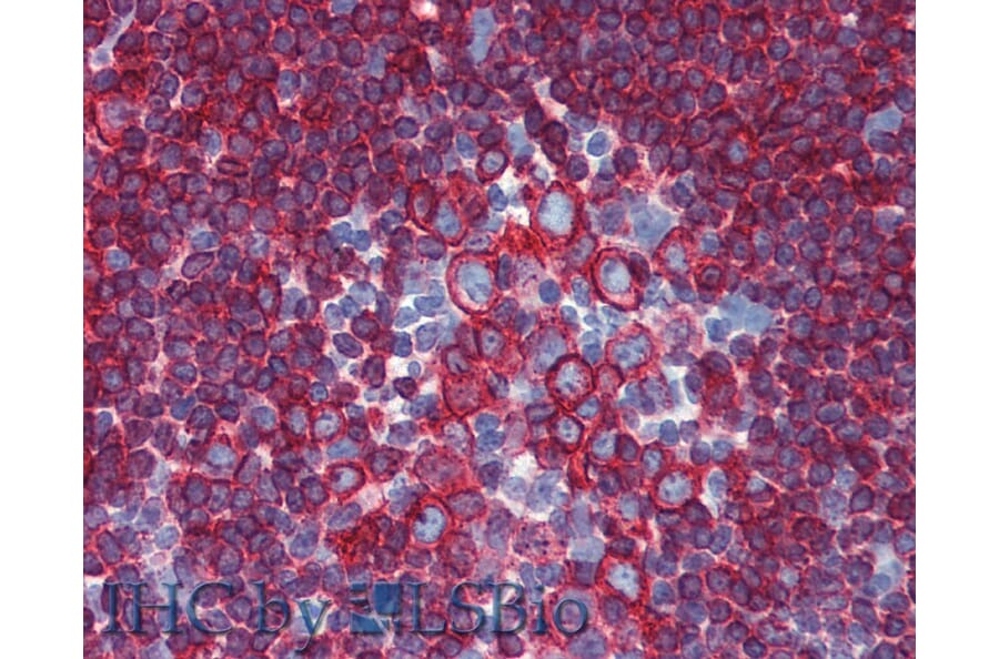 IHC - Anti-HLA DR + HLA DP Antibody [HL-40] (A85917)