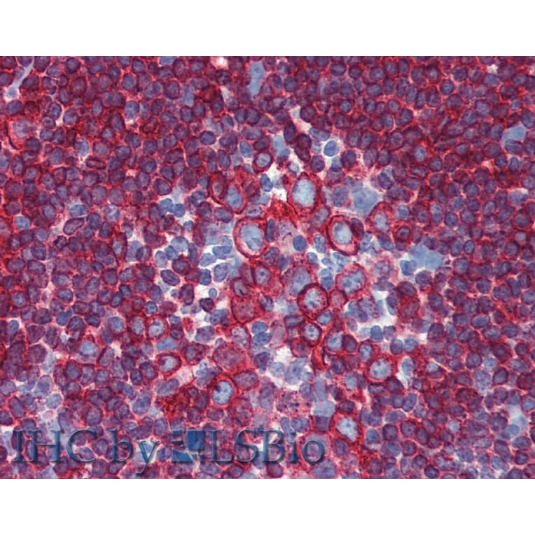IHC - Anti-HLA DR + HLA DP Antibody [HL-40] (A85917)