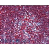 IHC - Anti-HLA DR + HLA DP Antibody [HL-40] (A85917)