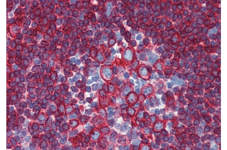 Immunohistochemistry - Anti-HLA DR + HLA DP Antibody [HL-40] (A85915) - Antibodies.com