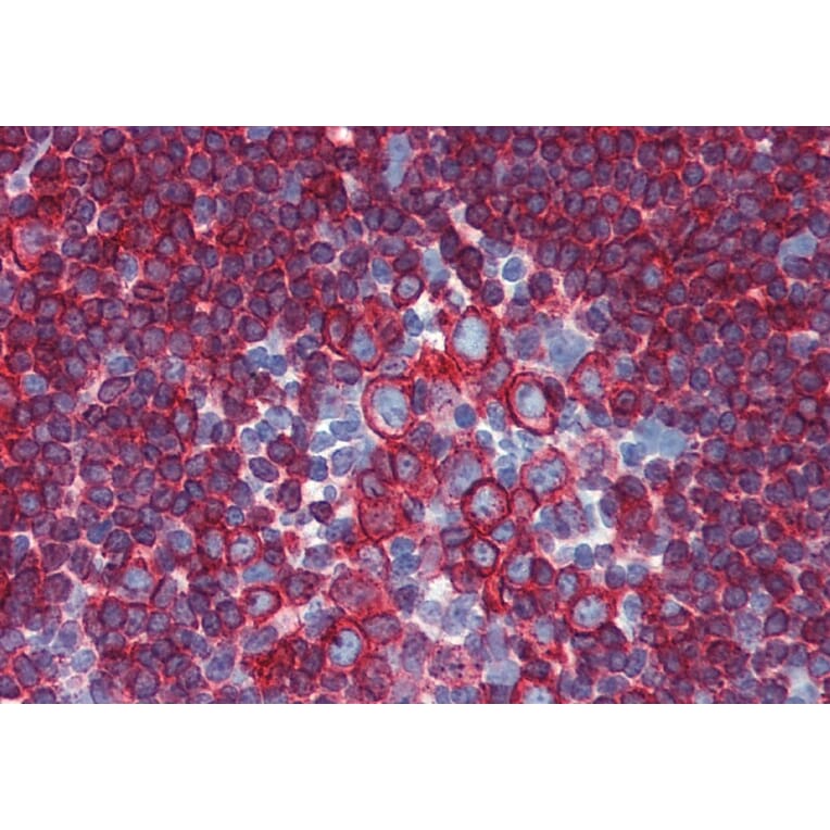 Immunohistochemistry - Anti-HLA DR + HLA DP Antibody [HL-40] (A85915) - Antibodies.com