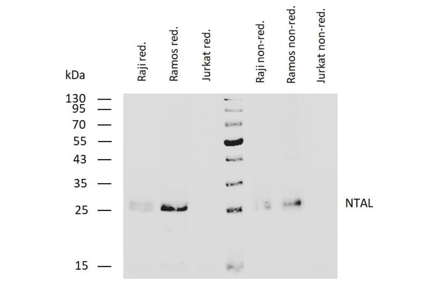WB - Anti-NTAL Antibody [NAP-07] (A85921)
