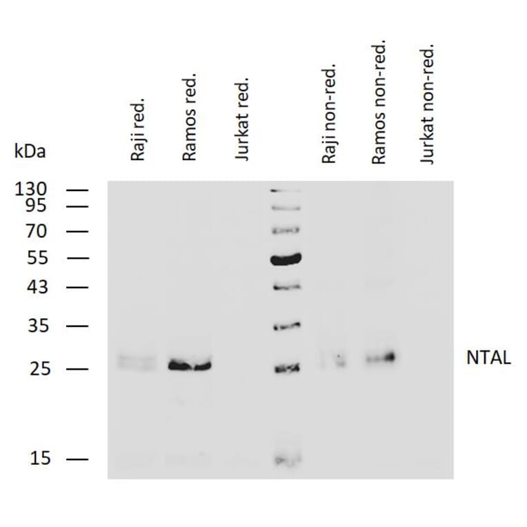 WB - Anti-NTAL Antibody [NAP-07] (A85921)