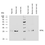 WB - Anti-NTAL Antibody [NAP-07] (A85921)