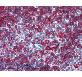IHC - Anti-HLA DR + HLA DP Antibody [HL-38] (A85931)