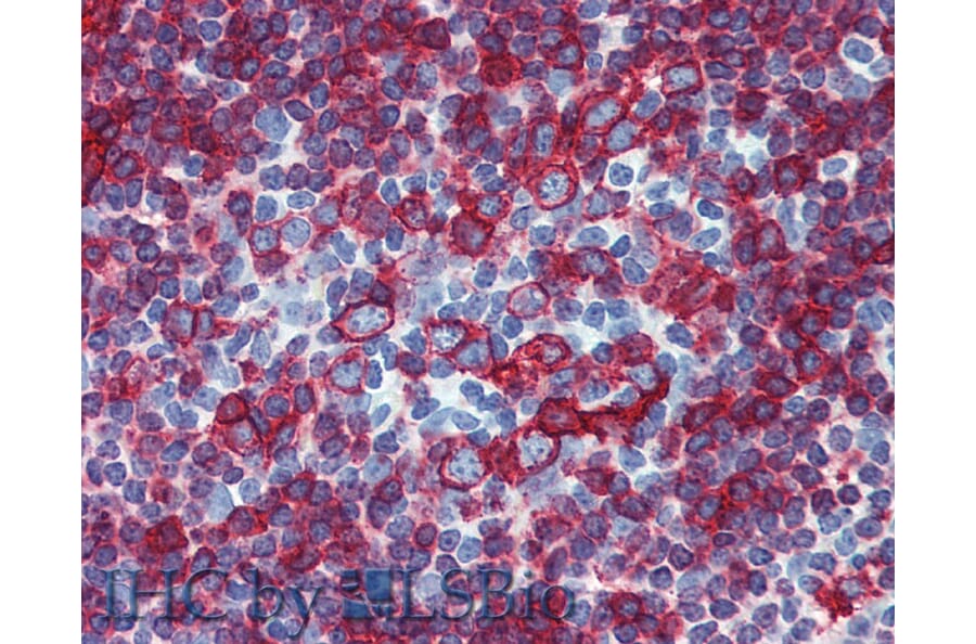 IHC - Anti-HLA DR + HLA DP Antibody [HL-38] (A85931)