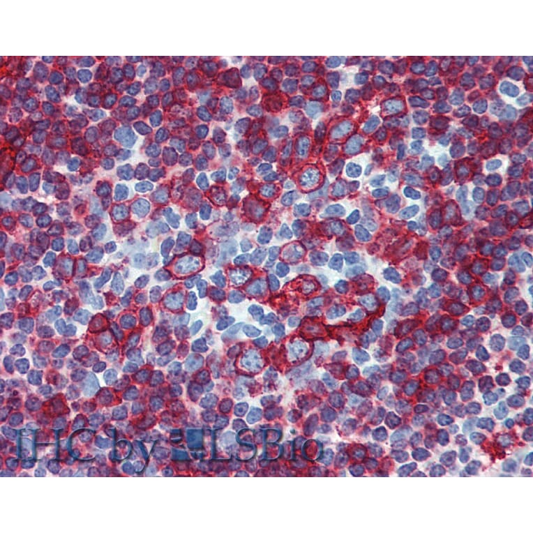 IHC - Anti-HLA DR + HLA DP Antibody [HL-38] (A85931)