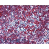 IHC - Anti-HLA DR + HLA DP Antibody [HL-38] (A85931)