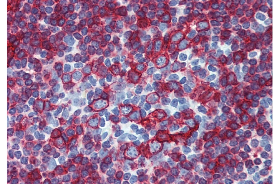 Immunohistochemistry - Anti-HLA DR + HLA DP Antibody [HL-38] (A85927) - Antibodies.com