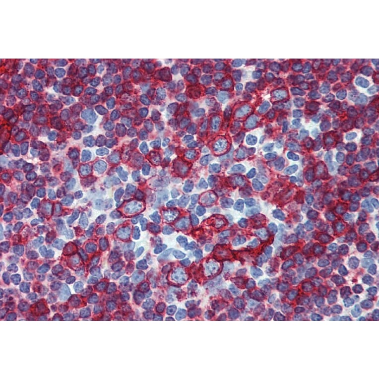 Immunohistochemistry - Anti-HLA DR + HLA DP Antibody [HL-38] (A85927) - Antibodies.com