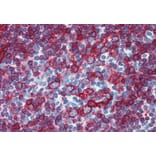 Immunohistochemistry - Anti-HLA DR + HLA DP Antibody [HL-38] (A85927) - Antibodies.com