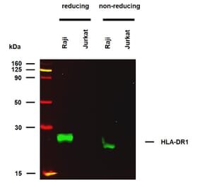 WB - Anti-HLA-DR Antibody [MEM-267] (A85933)