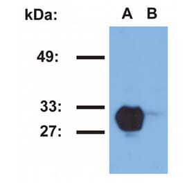 Western Blot - Anti-HLA DR Antibody [MEM-267] (A85931) - Antibodies.com
