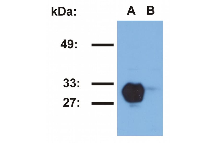 Western Blot - Anti-HLA DR Antibody [MEM-267] (A85931) - Antibodies.com