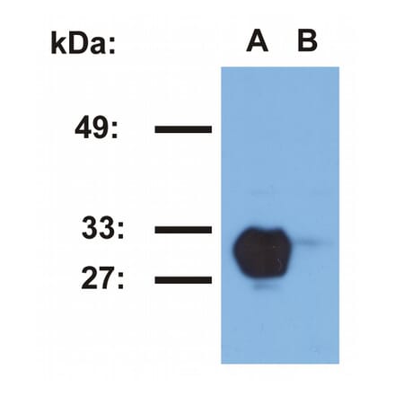 Western Blot - Anti-HLA DR Antibody [MEM-267] (A85931) - Antibodies.com