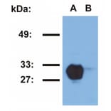 Western Blot - Anti-HLA DR Antibody [MEM-267] (A85931) - Antibodies.com