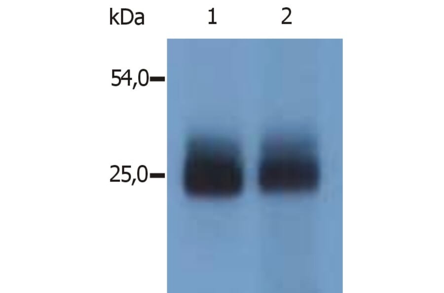 Western Blot - Anti-NTAL Antibody (A85965) - Antibodies.com