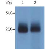 Western Blot - Anti-NTAL Antibody (A85965) - Antibodies.com
