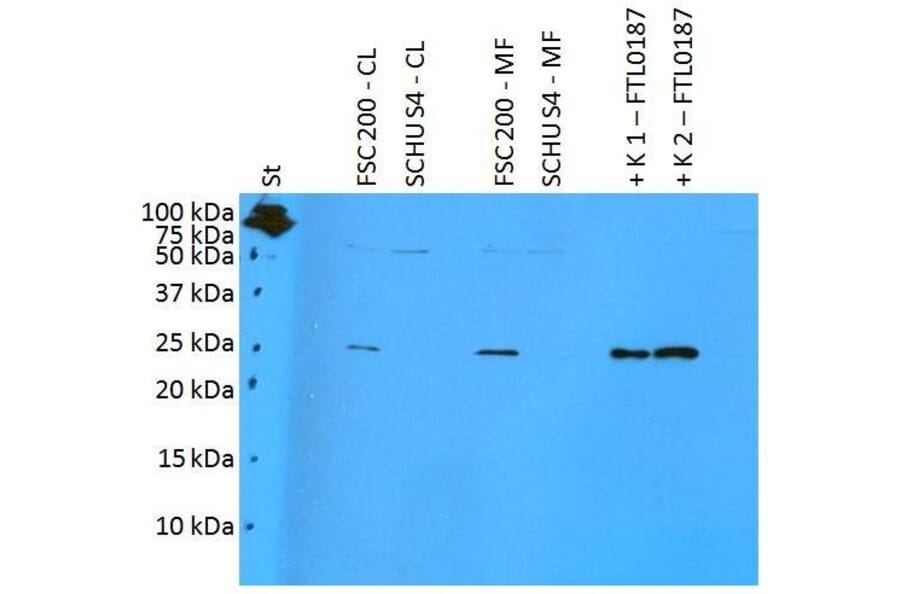 WB - Anti-F. tularensis ssp. holarctica FTL0187 Antibody (A85975)
