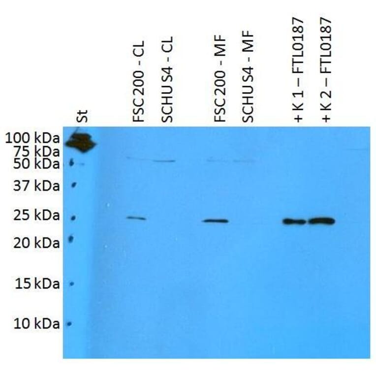 WB - Anti-F. tularensis ssp. holarctica FTL0187 Antibody (A85975)