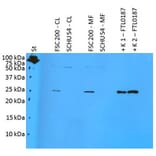 WB - Anti-F. tularensis ssp. holarctica FTL0187 Antibody (A85975)