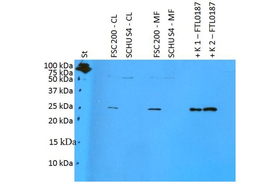 Western Blot - Anti-F. tularensis ssp. holarctica FTL0187 Antibody (A85973) - Antibodies.com