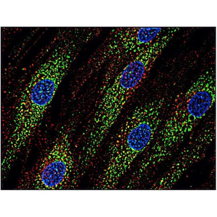 ICC - Anti-CD63 Antibody [MEM-259] (A85976)