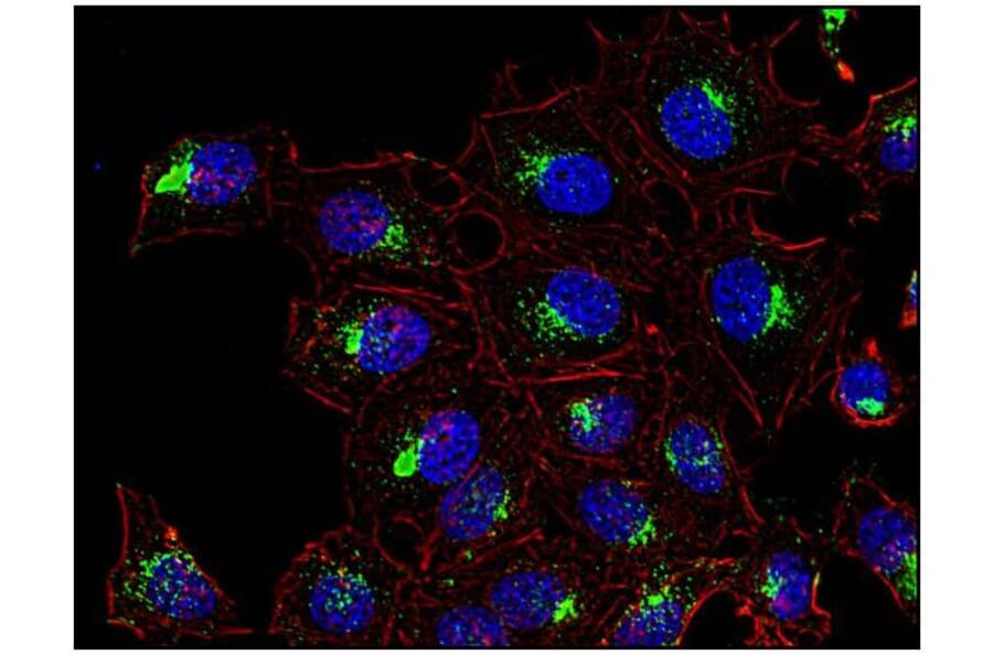 ICC - Anti-CD63 Antibody [MEM-259] (A85976)
