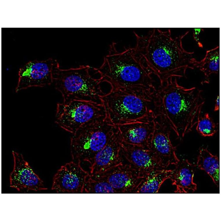 ICC - Anti-CD63 Antibody [MEM-259] (A85976)