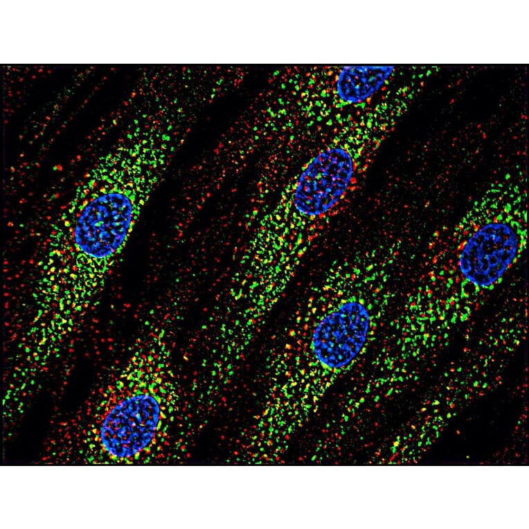 Immunocytochemistry - Anti-CD63 Antibody [MEM-259] (A85976) - Antibodies.com