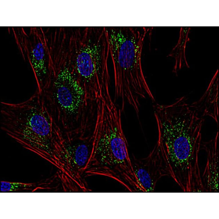Immunocytochemistry - Anti-CD63 Antibody [MEM-259] (A85976) - Antibodies.com