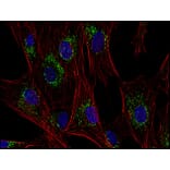Immunocytochemistry - Anti-CD63 Antibody [MEM-259] (A85976) - Antibodies.com