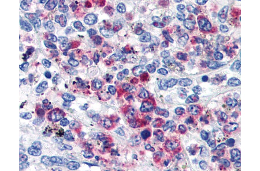 IHC - Anti-CD63 Antibody [MEM-259] (A85976)