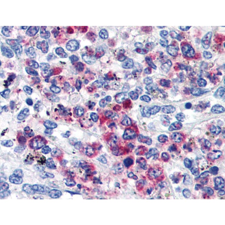 IHC - Anti-CD63 Antibody [MEM-259] (A85976)