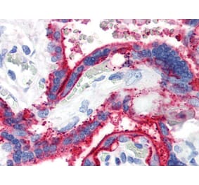 IHC - Anti-CD59 Antibody [MEM-43] (A85989)