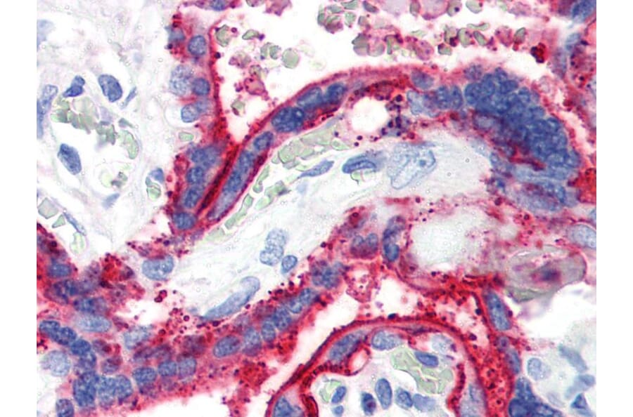 IHC - Anti-CD59 Antibody [MEM-43] (A85989)