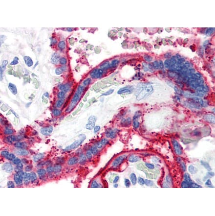 IHC - Anti-CD59 Antibody [MEM-43] (A85989)