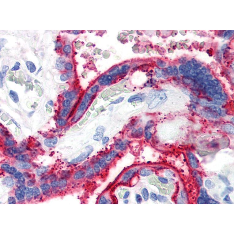 IHC - Anti-CD59 Antibody [MEM-43] (A85989)